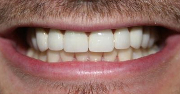 Cosmetic Dentistry2