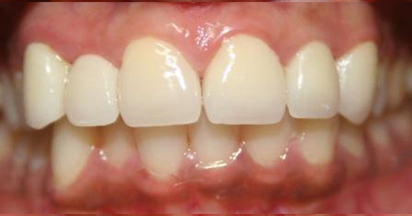Oral Rehabilitation and Alignment2